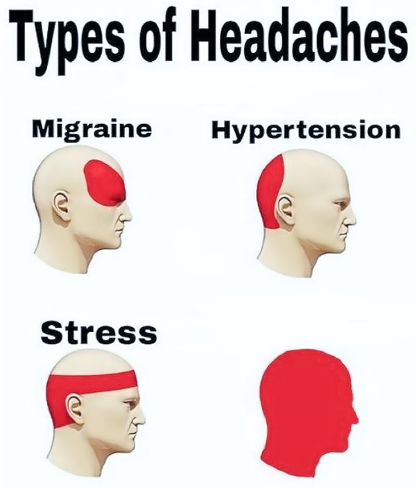 Types of Headaches
